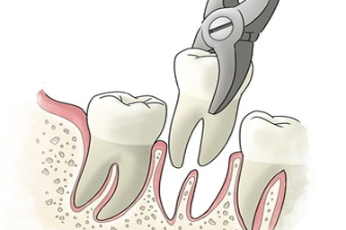 diş hekimi serkan zeybek denizli implant ortodonti estetik diş